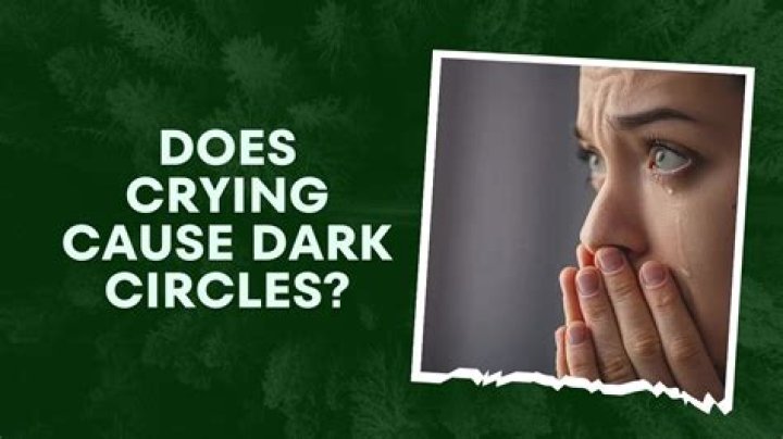 Does crying cause dark circles?