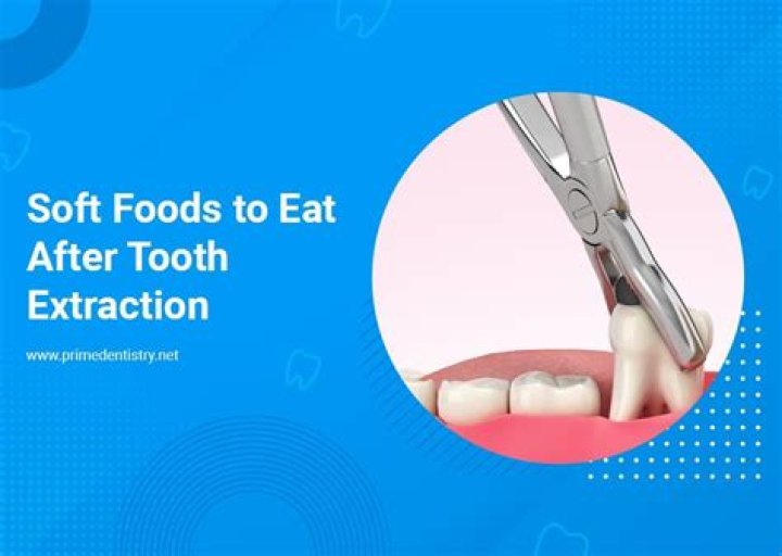 How soon can I eat after C-section?